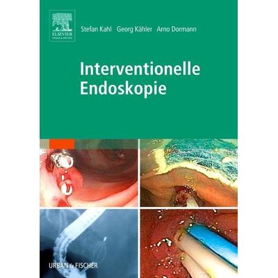 Interventionelle Endoskopie, Gebundene Ausgabe von Stefan Kahl,Georg, F. B. A. Kähler,Arno Dormann, Urban & Fischer in Elsevier, 978-3-437-23620-4