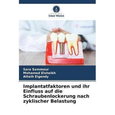 Implantatfaktoren und ihr Einfluss auf die Schraubenlockerung nach zyklischer Belastung, Taschenbuch von Sara Sammour,Mohamed Elsheikh,Attaih Elgendy,