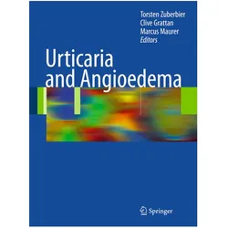 Urticaria and Angioedema, Fachbücher von Clive Grattan, Marcus Maurer, Torsten Zuberbier