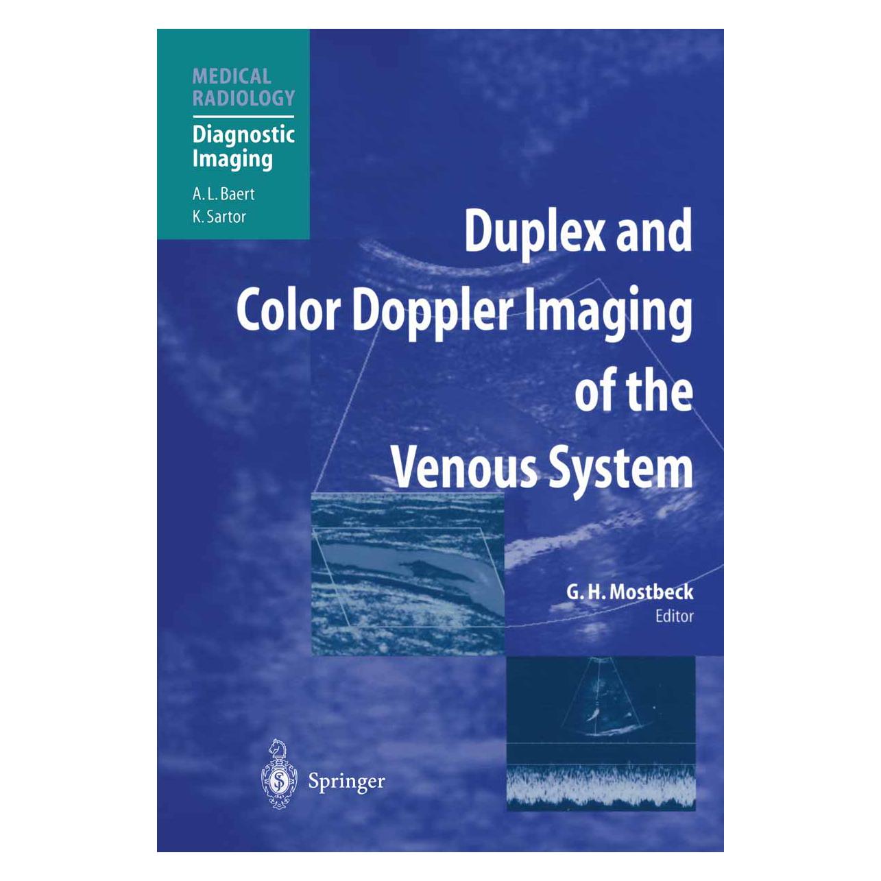 Springer Duplex and Color Doppler Imaging of the Venous System (Englisch, Softcover, Gerhard H. Mostbeck) (55560114)