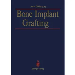 Bone Implant Grafting, Fachbücher