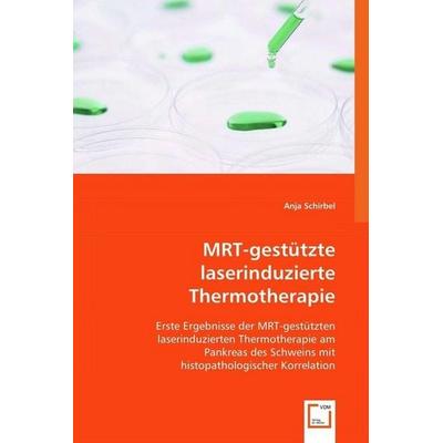 Schirbel, A: MRT-gestützte laserinduzierte Thermotherapie, Taschenbuch von Anja Schirbel, VDM, 978-3-639-00200-3
