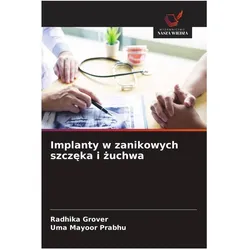 Implanty w zanikowych szczeka i zuchwa, Ratgeber von Radhika Grover, Uma Mayoor Prabhu