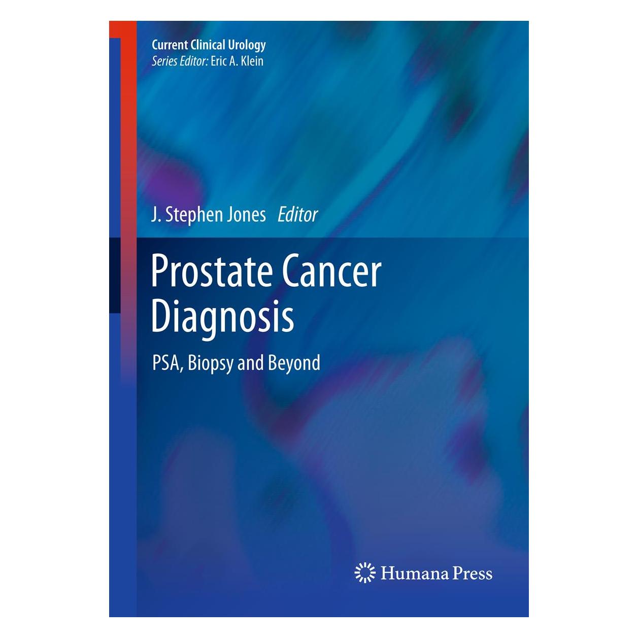 Humana Press Prostate Cancer Diagnosis (Englisch, Hardcover, J. Stephen Jones) (9781627031875)