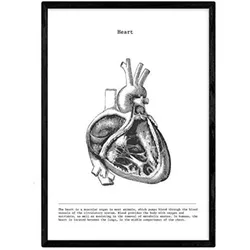 POSTER Anatomie Herz A3 Schwarzer Rahmen