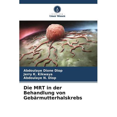 Die MRT in der Behandlung von Gebärmutterhalskrebs, Taschenbuch von Abdoulaye Dione Diop,Jerry K. Kikwaya,Abdoulaye N. Diop, Verlag Unser Wissen,