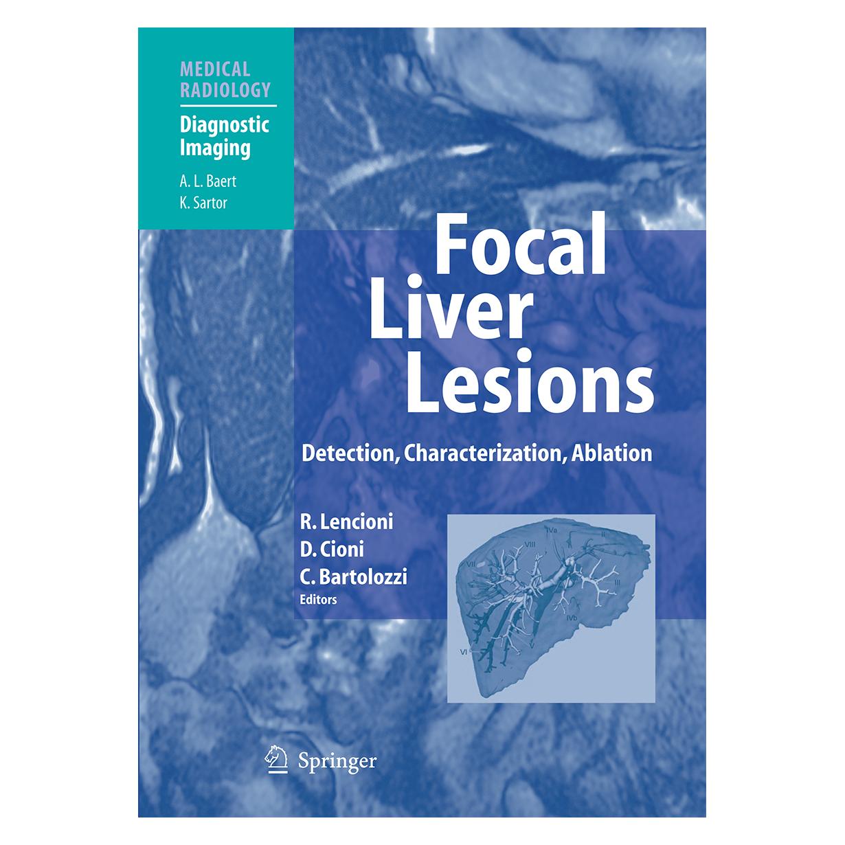 Springer Focal Liver Lesions (Englisch, Softcover, Carlo Bartolozzi, Dania Cioni, Riccardo Lencioni) (55376215)