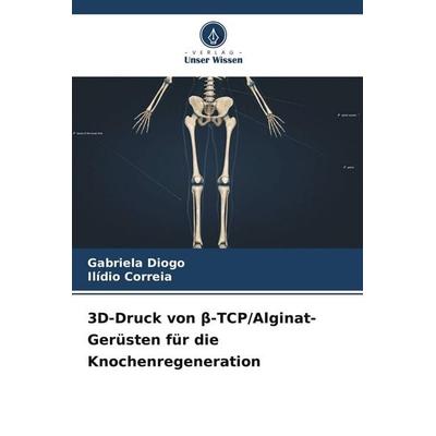 3D-Druck von ¿-TCP/Alginat-Gerüsten für die Knochenregeneration, Taschenbuch von Gabriela Diogo,Ilídio Correia, Verlag Unser Wissen