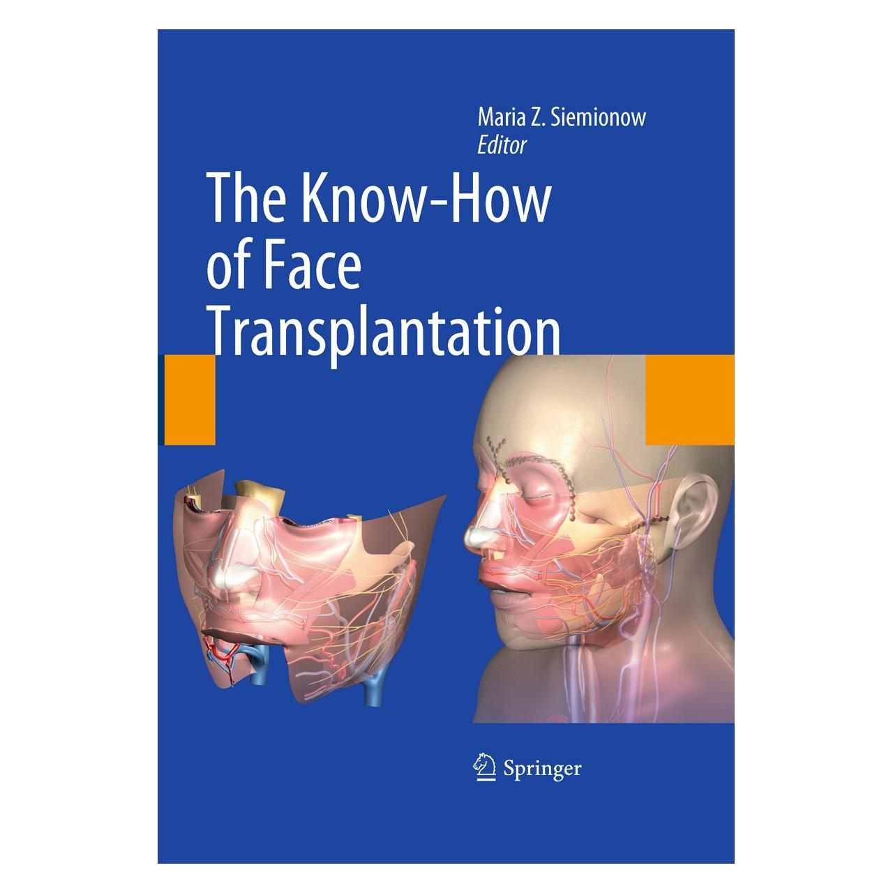 Springer The Know-How of Face Transplantation (Englisch, Hardcover, Maria Z. Siemionow) (9780857292520)