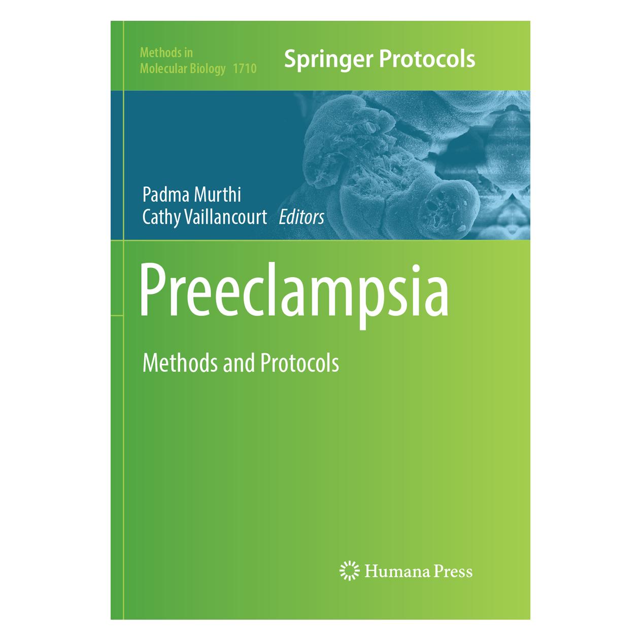 Springer Preeclampsia (Englisch, Softcover, Cathy Vaillancourt, Padma Murthi) (56053874)
