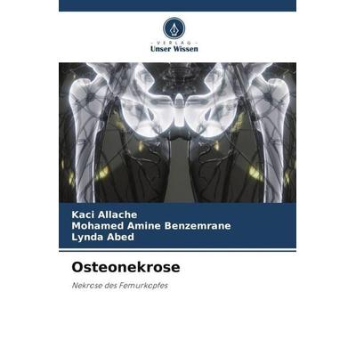 Osteonekrose, Taschenbuch von Kaci Allache,Mohamed Amine Benzemrane,Lynda Abed, Verlag Unser Wissen, 978-620-5-92371-9