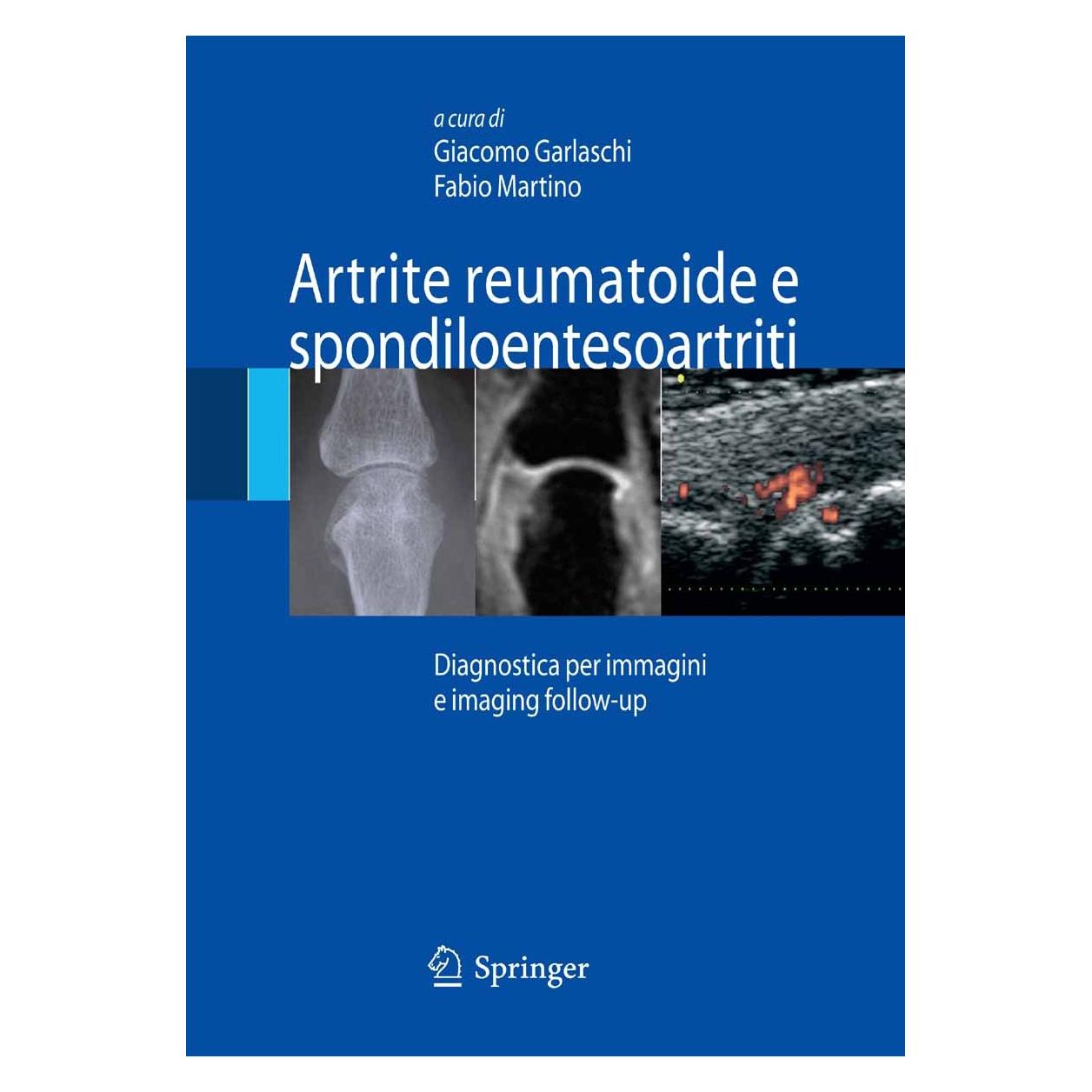 Springer Artrite reumatoide e spondiloentesoartriti (Italienisch, Hardcover, Fabio Martino, Giacomo Garlaschi) (9788847006850)