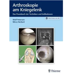 Petersen:Arthroskopie am Kniegelenk, Fachbücher von Mirco Herbort, Wolf Petersen