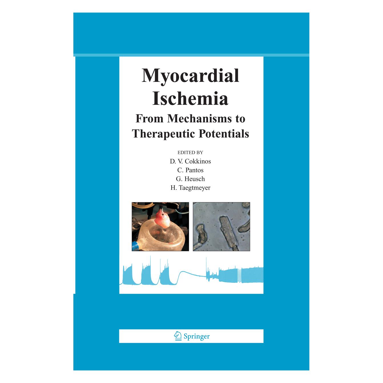 Springer Myocardial Ischemia (Englisch, Softcover, C. Pantos, Dennis V. P. Cokkinos, Gerd Heusch, H. Taegtmeyer) (55573320)