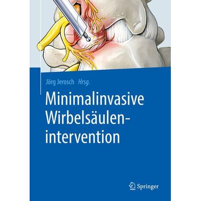 Minimalinvasive Wirbelsäulenintervention, Gebundene Ausgabe von , Springer Berlin, 978-3-662-58093-6