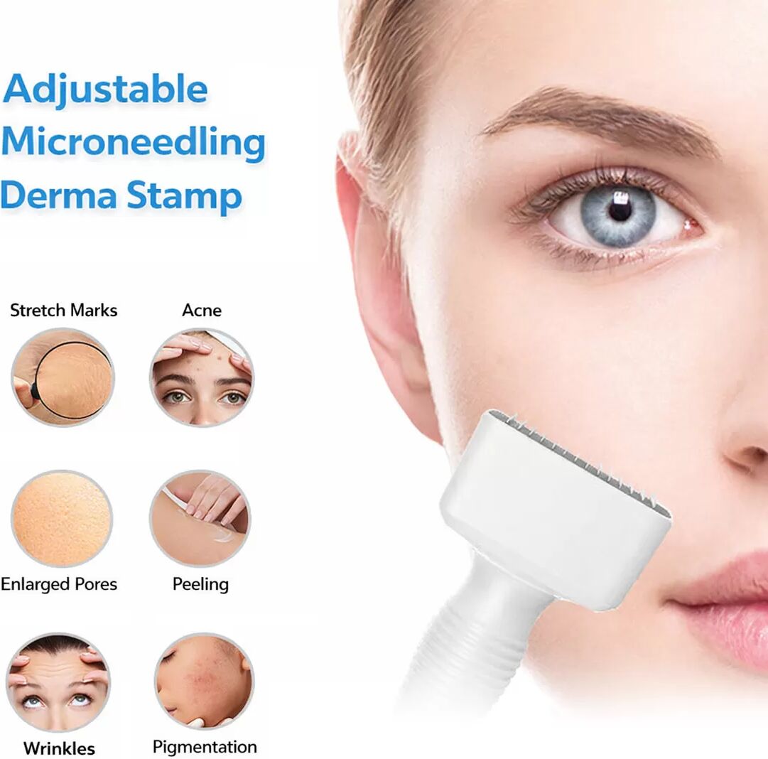 INF 140A Einstellbarer Microneedle Derma Stamp Roller – Weißes ABS Microneedling-Tool für Gesicht & Körper