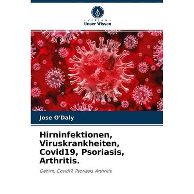 Hirninfektionen, Viruskrankheiten, Covid19, Psoriasis, Arthritis., Taschenbuch von Jose O'Daly; Verlag Unser Wissen, 978-620-4-24049-7