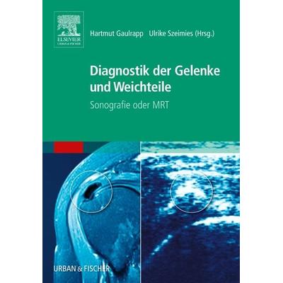 Diagnostik der Gelenke und Weichteile, Gebundene Ausgabe von Hartmut Gaulrapp,Ulrike Szeimies, Urban & Fischer in Elsevier, 978-3-437-24370-7