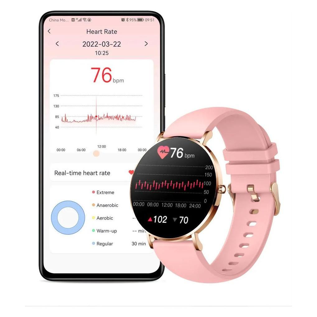 Manta Alexa SWU501PK Pink (43 mm, ohne SIM) (SWU501PK)