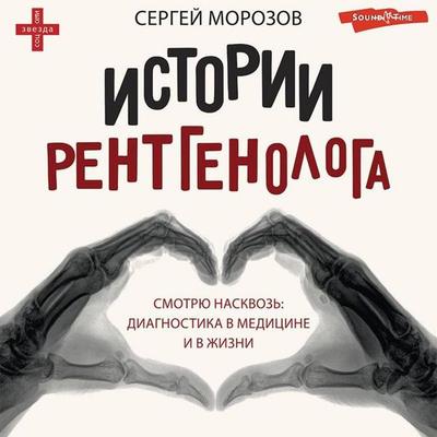Istorii rentgenologa. Smotryu naskvoz: diagnostika v meditsine i v zhizni. - Sergey Morozov, Audio, 9785171430771