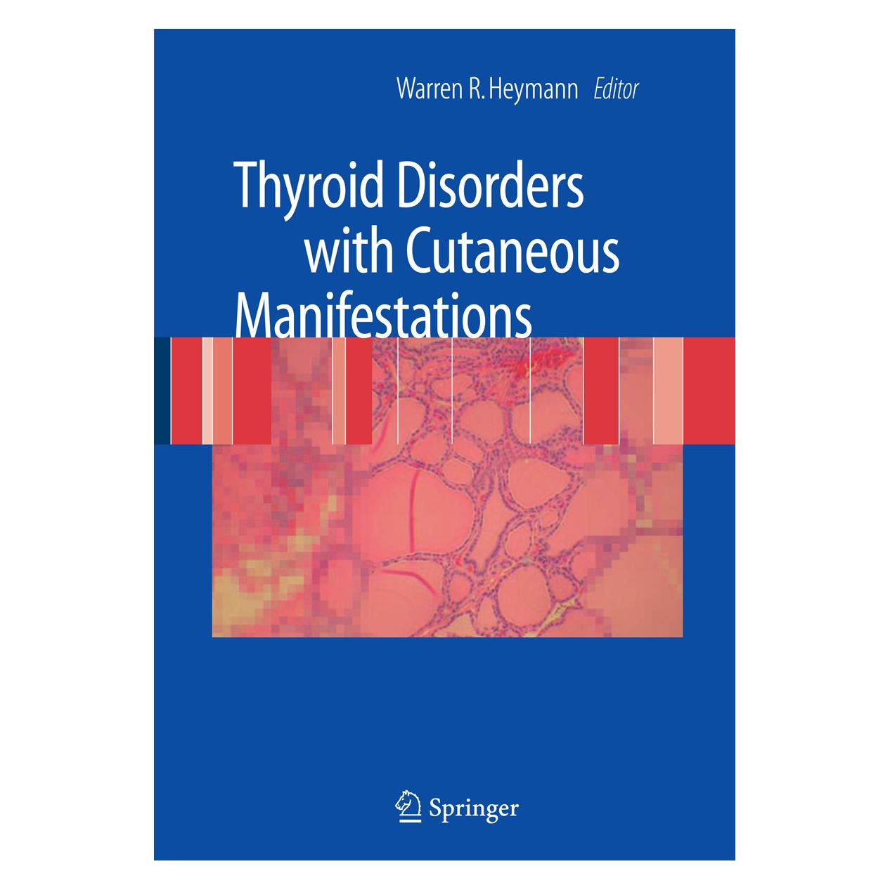 Springer Thyroid Disorders with Cutaneous Manifestations (Englisch, Hardcover, Warren R. Heymann) (9781848001862)