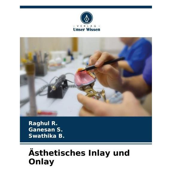 Umbreit R.:Ãsthetisches Inlay und Onlay (Deutsch, Softcover, Ganesan S, Raghul R, Swathika B) (63585392)