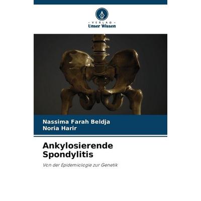 Ankylosierende Spondylitis, Taschenbuch von Nassima Farah Beldja,Noria Harir, Verlag Unser Wissen, 978-620-9-57785-7