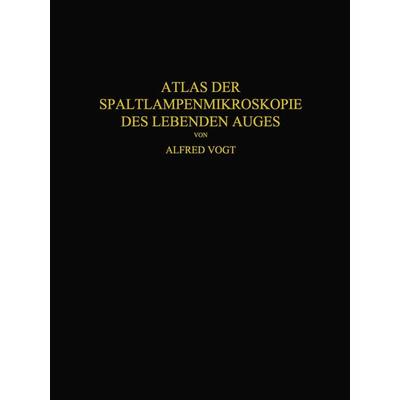 Atlas der Spaltlampenmikroskopie des Lebenden Auges, Taschenbuch von Alfred Vogt, Springer Berlin, 978-3-642-90497-4