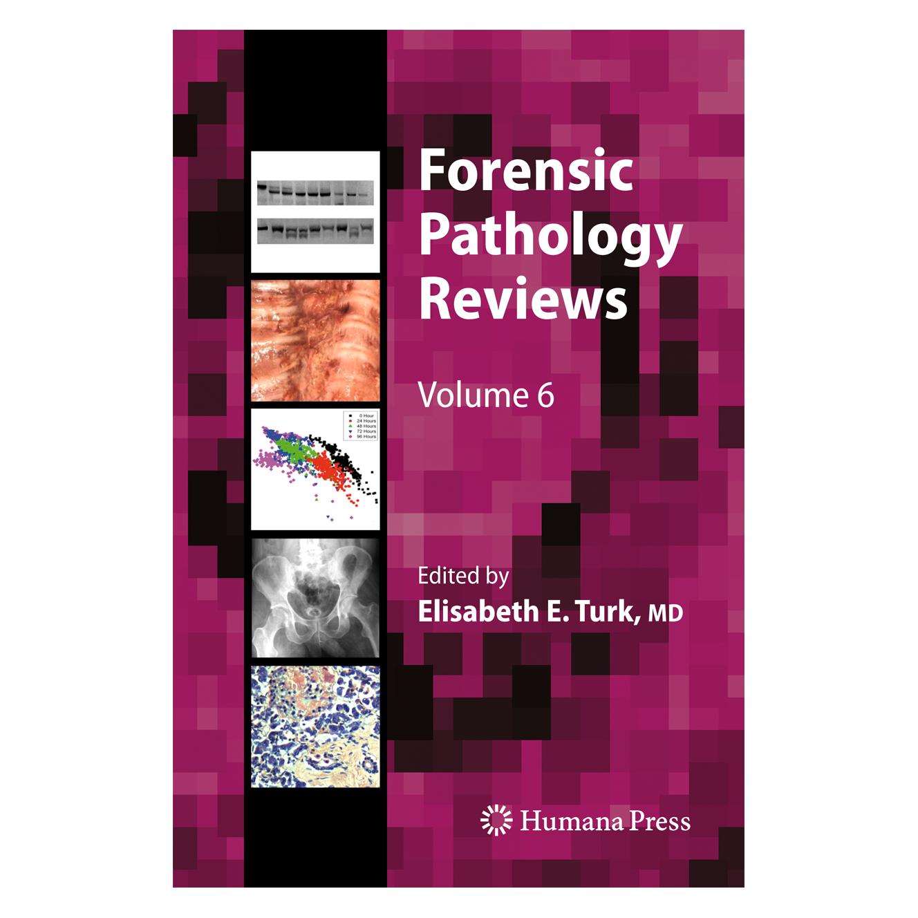 Springer Forensic Pathology Reviews (Englisch, Softcover) (55529099)