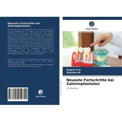 Neueste Fortschritte bei Zahnimplantaten, Taschenbuch von Rajesh K. S.,Gokulan M., Verlag Unser Wissen, 978-620-4-05982-2