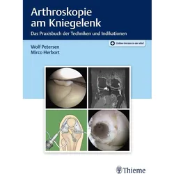 Petersen:Arthroskopie am Kniegelenk, Fachbücher von Mirco Herbort, Wolf Petersen