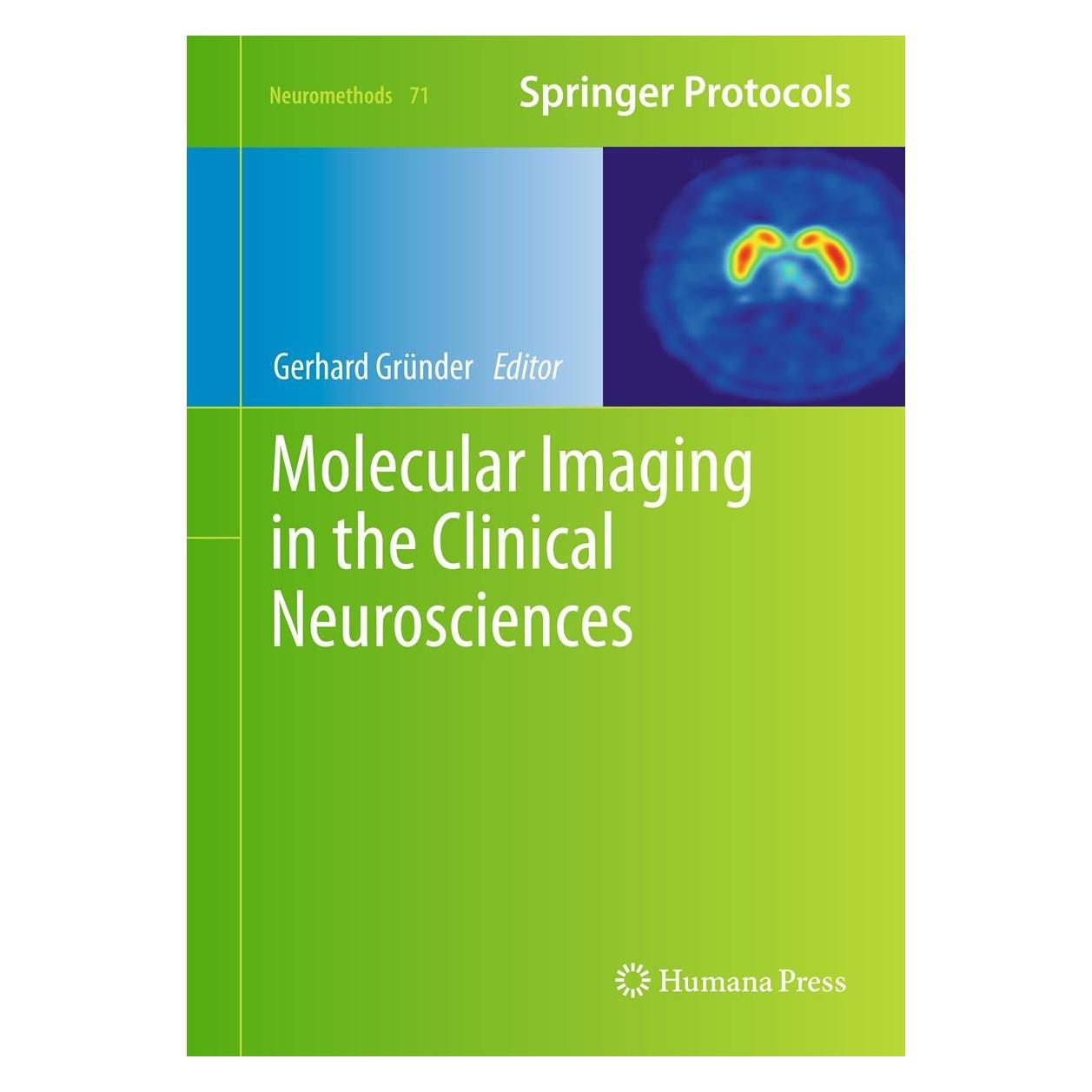 Springer Molecular Imaging in the Clinical Neurosciences (Englisch, Hardcover, Gerhard Gründer) (9781617799884)