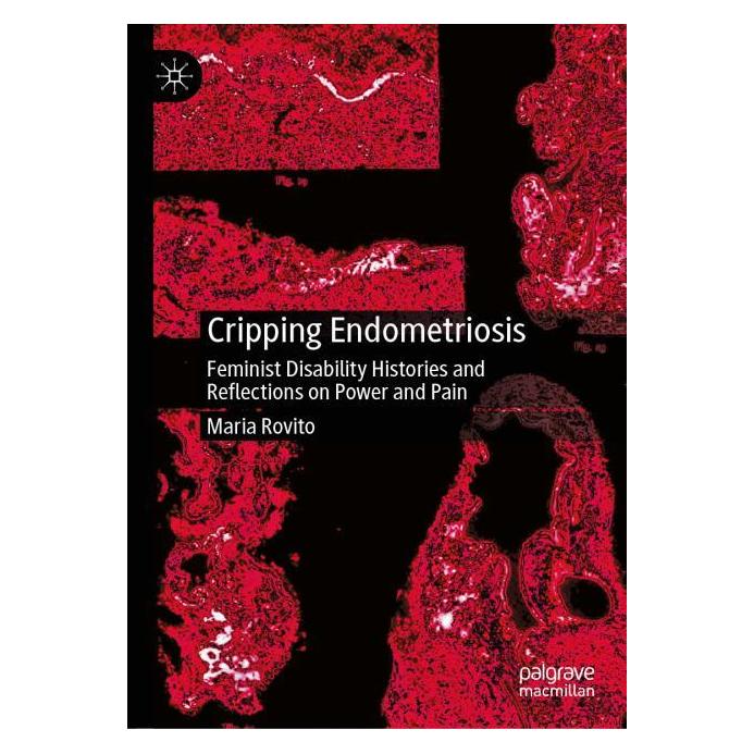 Springer Cripping Endometriosis (Englisch, Hardcover, Maria Rovito) (65431438)