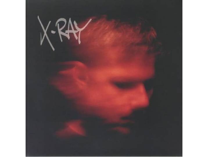 X-Ray