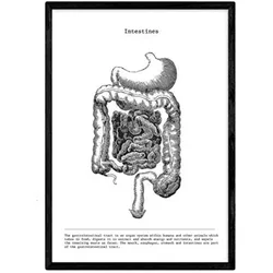 POSTER Anatomie Darm A3 Schwarzer Rahmen