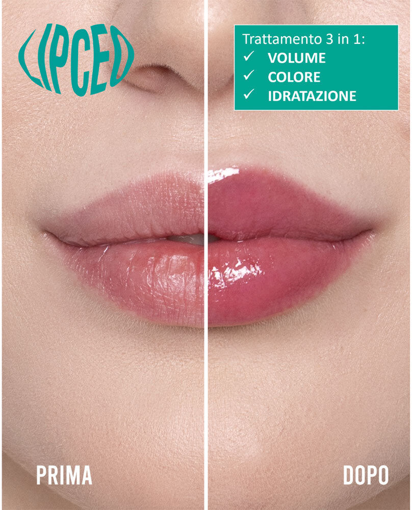 Mulac Lip CEO