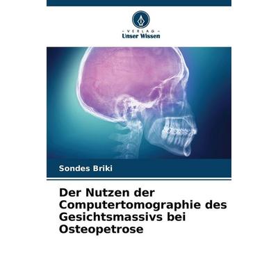 Der Nutzen der Computertomographie des Gesichtsmassivs bei Osteopetrose, Taschenbuch von Sondes Briki, Verlag Unser Wissen, 978-620-9-10239-4