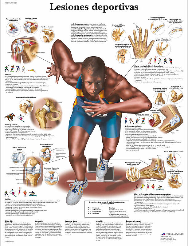 Lâmina de anatomia: Lesões desportivas