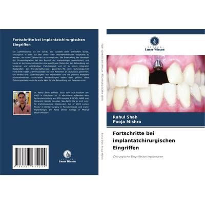 Fortschritte bei implantatchirurgischen Eingriffen, Taschenbuch von Rahul Shah,Pooja Mishra, Verlag Unser Wissen, 978-620-7-63521-4
