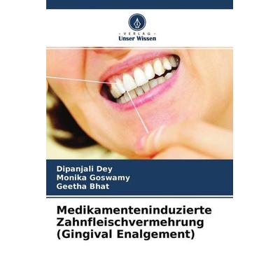 Medikamenteninduzierte Zahnfleischvermehrung (Gingival Enalgement), Taschenbuch von Dipanjali Dey,Monika Goswamy,Geetha Bhat, Verlag Unser Wissen,