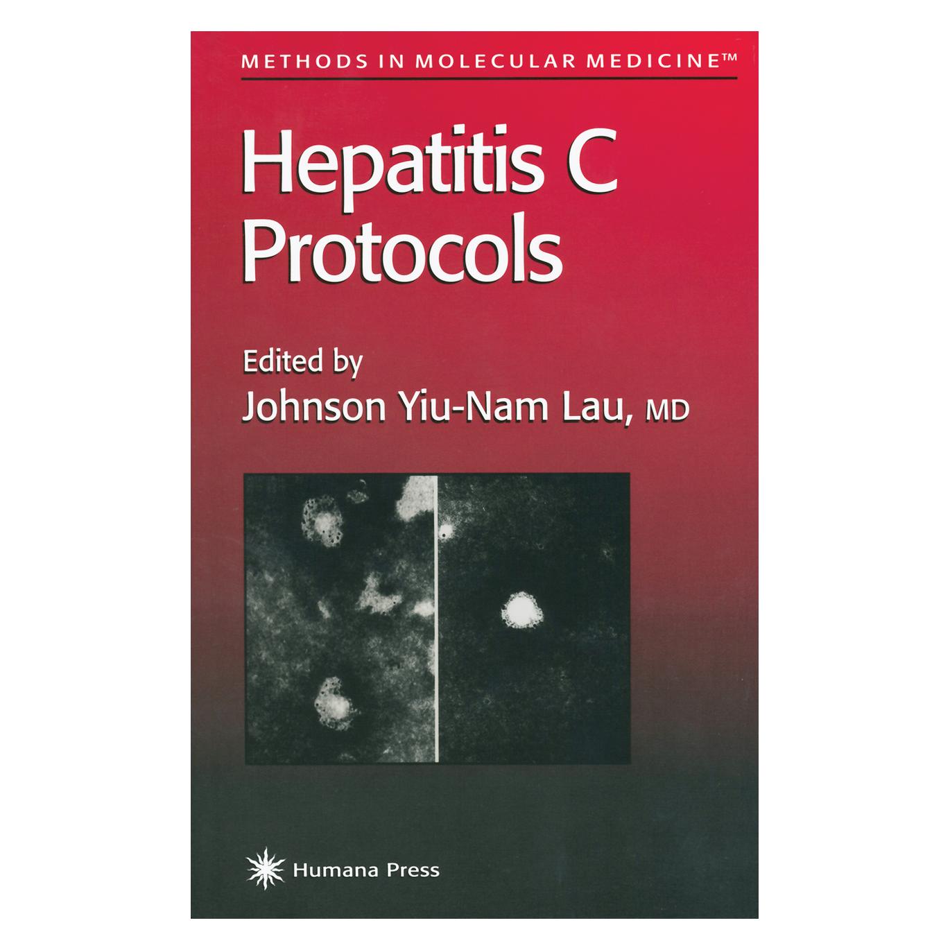 Springer Hepatitis C Protocols (Englisch, Johnson Y. N. Lau) (55559897)