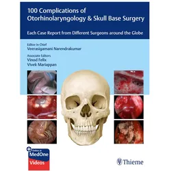 100 Complications of Otorhinolaryngology & Skull Base Surgery, Ratgeber von Vinod Mariappan, Vivek Felix, Veerasigamani Narendrakumar