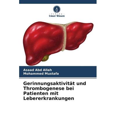 Gerinnungsaktivität und Thrombogenese bei Patienten mit Lebererkrankungen, Taschenbuch von Asaad Abd Allah,Mohammed Mustafa, Verlag Unser Wissen,