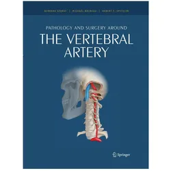 Pathology and surgery around the vertebral artery, Fachbücher von Bernard George, Robert Spetzler, Michal Bruneau