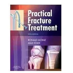 Practical Fracture Treatment, Sachbücher von Max Esser