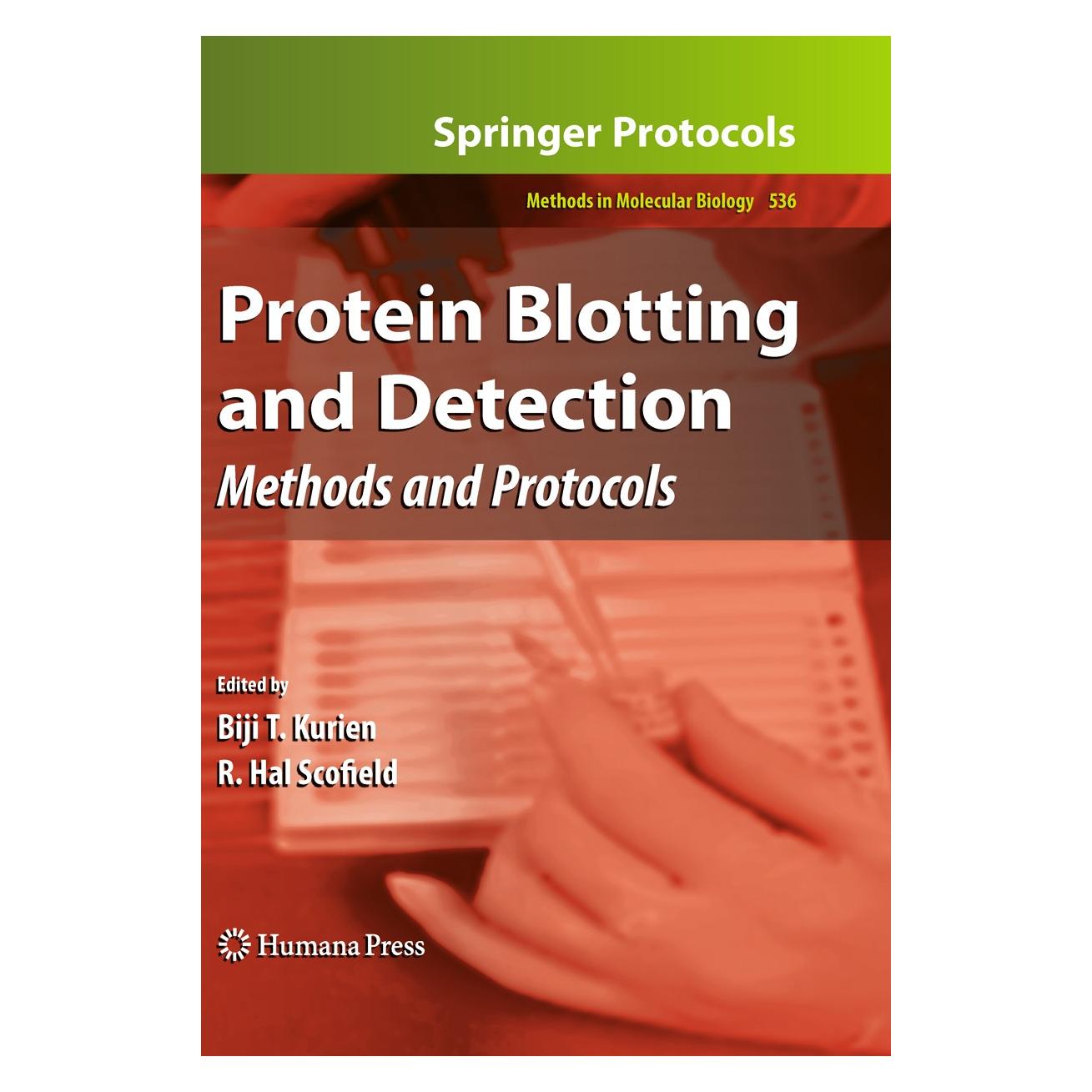 Humana Press Protein Blotting and Detection (Englisch, Hardcover, Biji T. Kurien, R. Hal Scofield) (9781934115732)