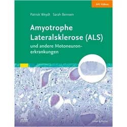 ELSEVIER ESSENTIALS ALS und andere Motoneuronerkrankungen, Fachbücher von Sarah Bernsen, Patrick Weydt, Peter Körtvelyessy, Johannes Friese