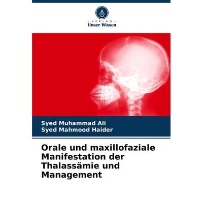 Orale und maxillofaziale Manifestation der Thalassämie und Management, Taschenbuch von Syed Muhammad Ali,Syed Mahmood Haider, Verlag Unser Wissen,