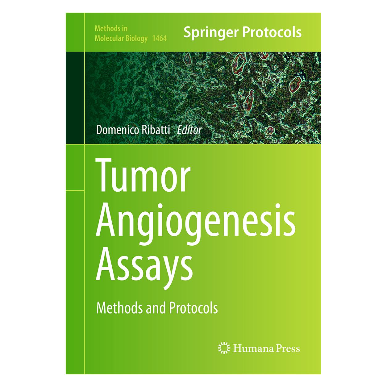 Springer Tumor Angiogenesis Assays (Englisch, Hardcover, Domenico Ribatti) (9781493939978)