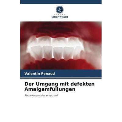Der Umgang mit defekten Amalgamfüllungen, Taschenbuch von Valentin Penaud, Verlag Unser Wissen